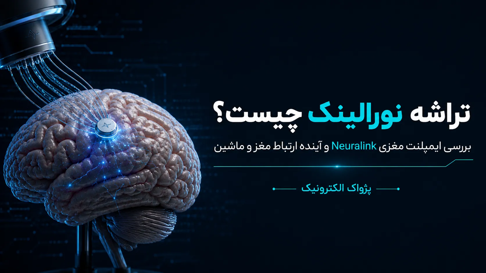 tarasheh-neuralink-chist